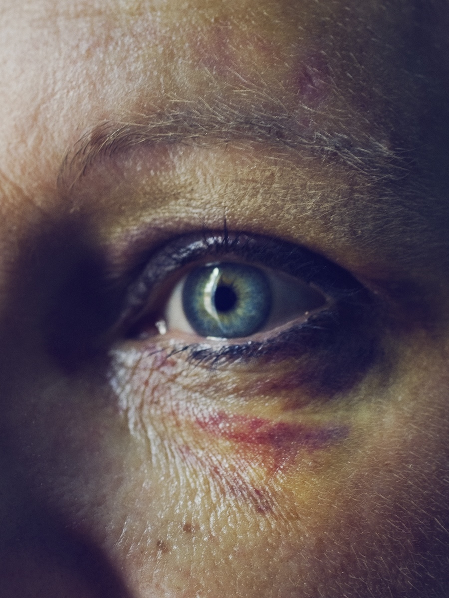 Unibrow Radio: Christopher Anderson